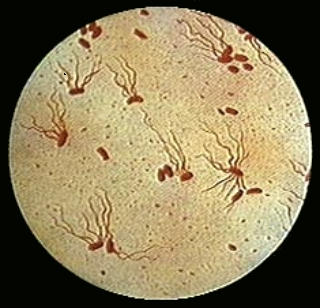 salmonella typhi diagnostic image