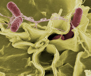 salmonella typhi morphology image